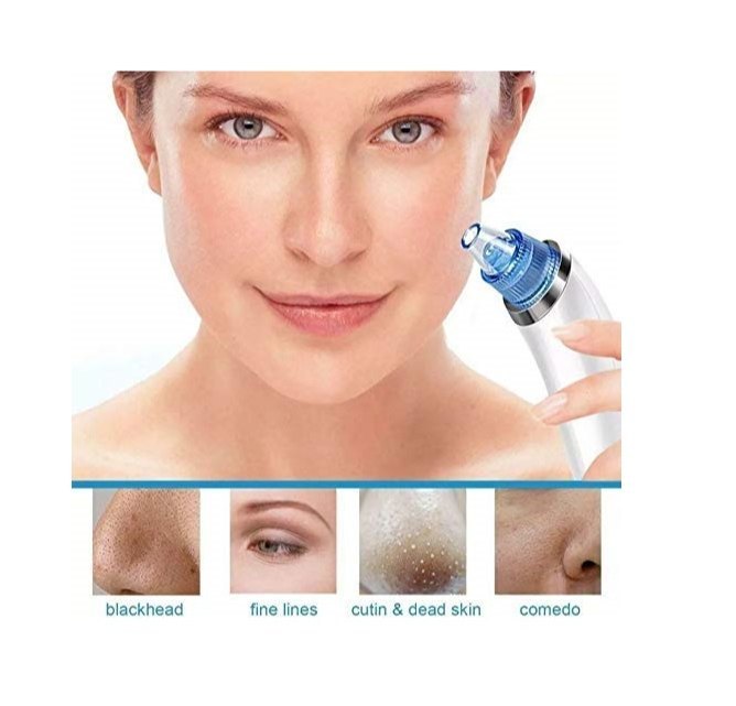 ABS Plastic White Derma Suction Blackhead Remover, For Parlour, Normal Skin