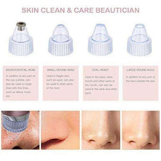 ABS Plastic White Derma Suction Blackhead Remover, For Parlour, Normal Skin